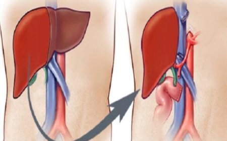 59 वर्षीय व्यक्ति को मिला नया जीवन, ब्रेन-डेड डोनर बना मसीहा